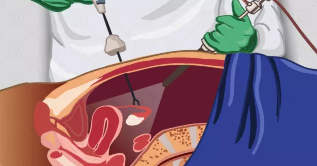 General and Laparoscopic Surgery